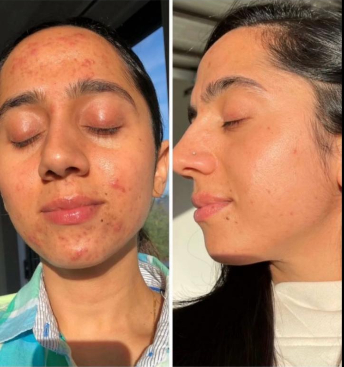 Client transformation